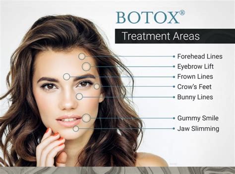 Is Botox good for anxiety?