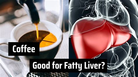 Is Coffee good for the liver?