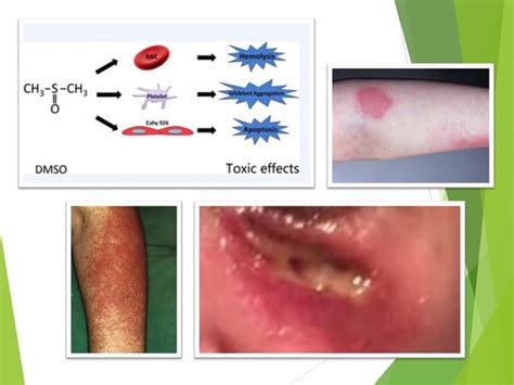 Is DMSO toxic to humans?