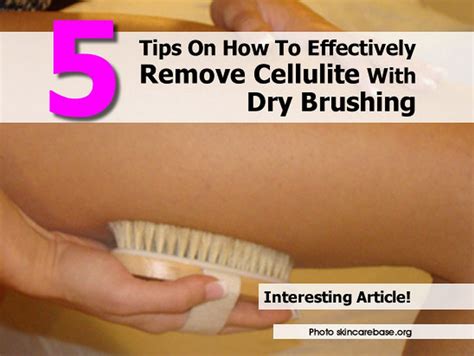 Is Dry brushing good for cellulite?