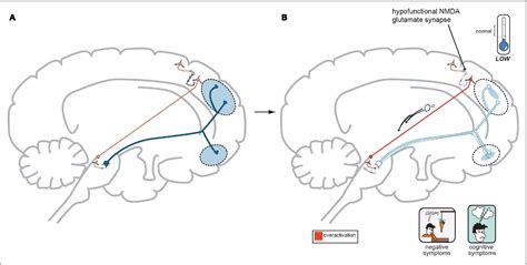 Is GABA high or low in schizophrenia?