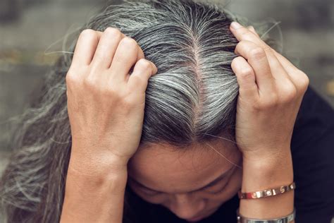 Is Grey hair caused by stress?
