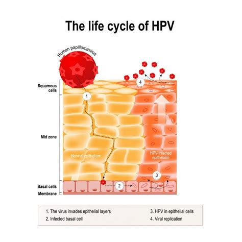 Is HPV a life long infection?