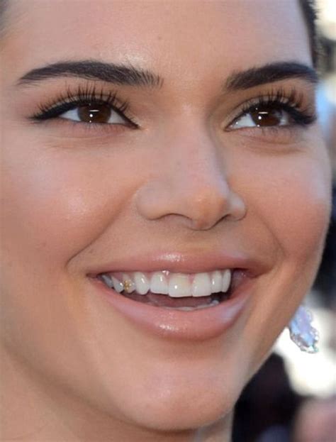 Is Kendall Jenner missing a tooth?