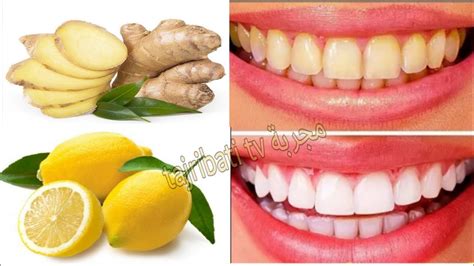 Is Lemon good for your teeth?