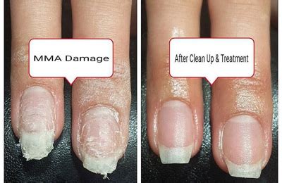 Is MMA in nail glue?