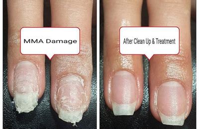 Is MMA used in gel nails?