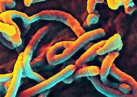 Is Marburg worse than Ebola?