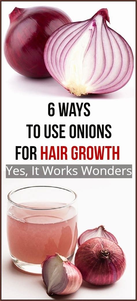 Is Onion good for your hair?