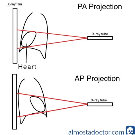 Is PA+++ better than PA++++?