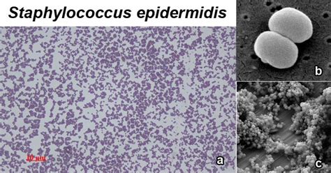 Is S epidermidis salt tolerant?