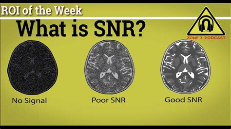 Is SNR good or bad?
