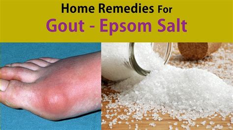 Is Salt bad for gout?