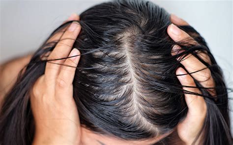 Is Short hair better for oily scalp?