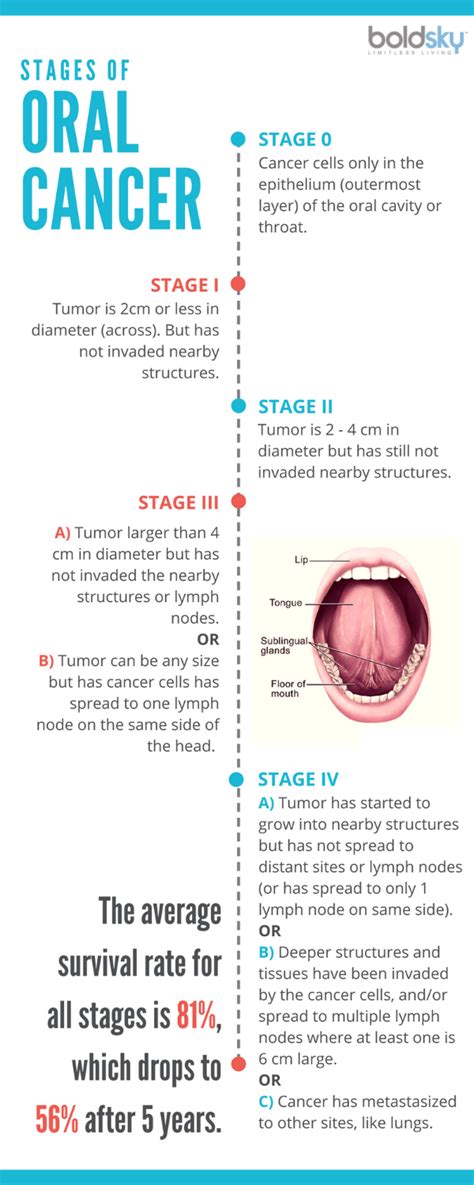 Is Stage 2 oral cancer curable?