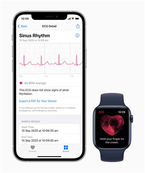 Is The Apple Watch ECG accurate?