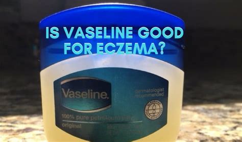 Is Vaseline good for mites?