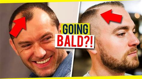 Is a balding guy a turn off?