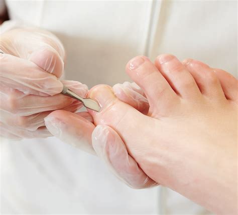 Is a medical pedicure a real thing?