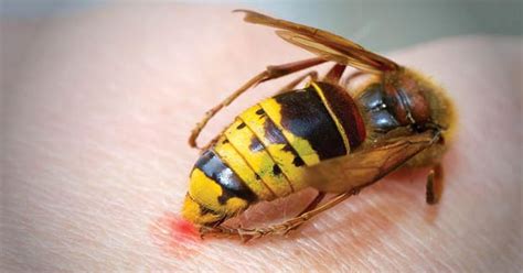 Is a wasp or bee sting worse?