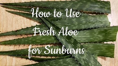 Is aloe vera good for 2nd degree burns?