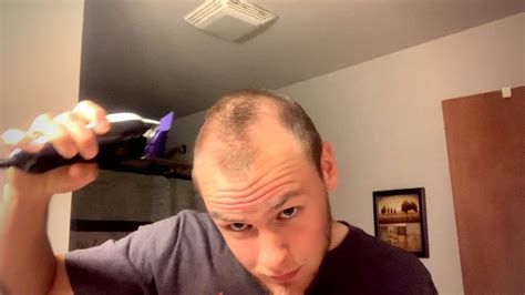 Is balding a turn off?