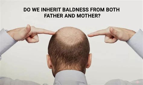 Is baldness from mom or dad?