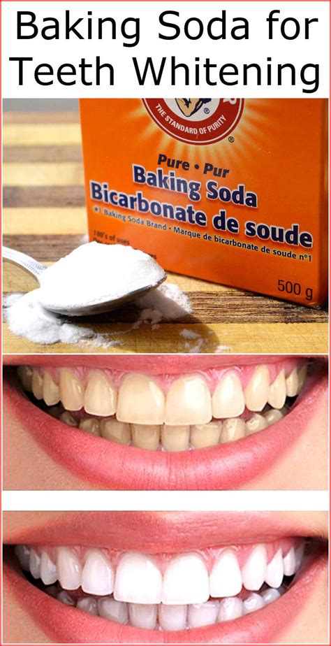 Is bicarbonate of soda good for teeth?