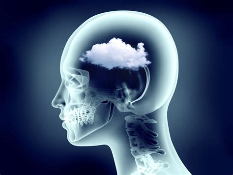 Is brain fog OK?