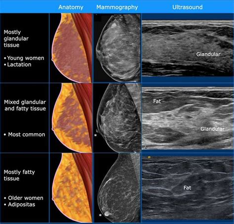 Is breast tissue or fat heavier?