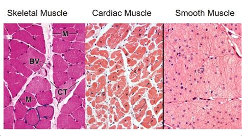 Is cardiac muscle smooth or skeletal?