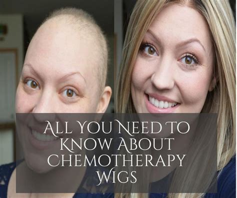 Is chemo free in Canada?