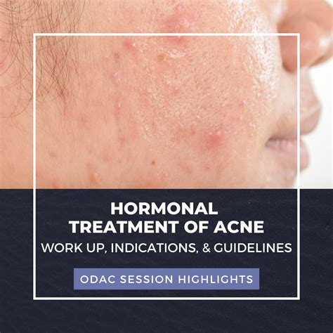 Is chest acne hormonal?