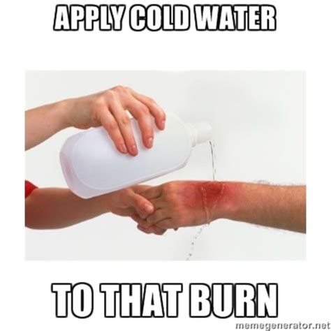 Is cold water or ice better for burns?