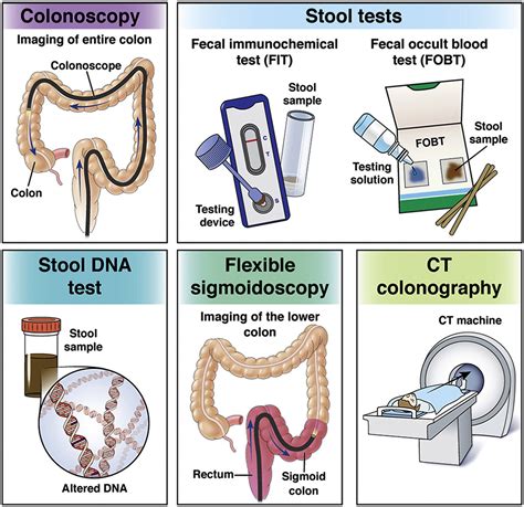 Is colorectal genetic?