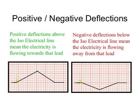 Is deflection positive or negative?