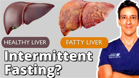 Is fasting good for the liver?