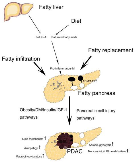 Is fatty pancreas reversible?