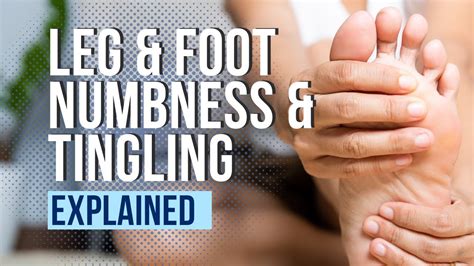 Is foot numbness a disability?