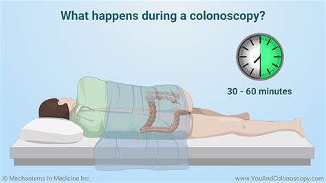 Is gas an after effect of colonoscopy?