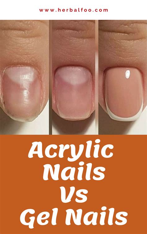 Is gel or acrylic better for weak nails?