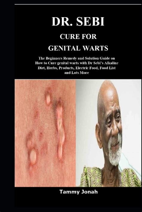Is genital warts 100% curable?