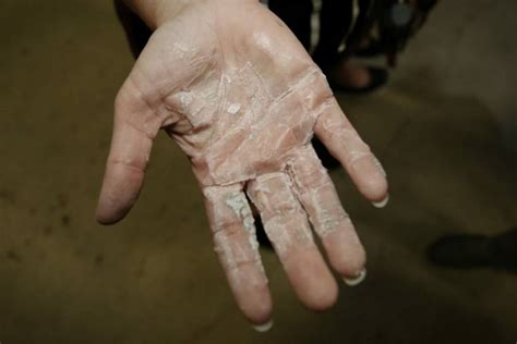 Is glue on hand harmful?