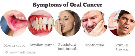 Is gum cancer painful?