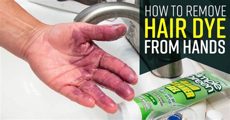 Is hair dye on hands bad?