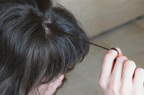 Is hair picking anxiety?