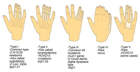 Is hand shape genetic?
