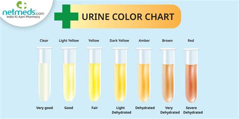 Is healthy urine transparent?