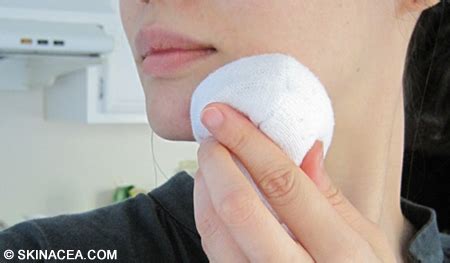 Is hot or cold compress better for acne cysts?