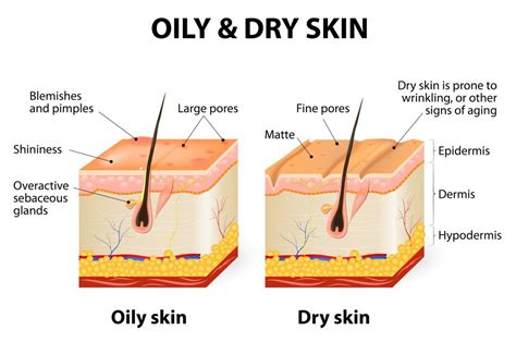 Is human skin oily?